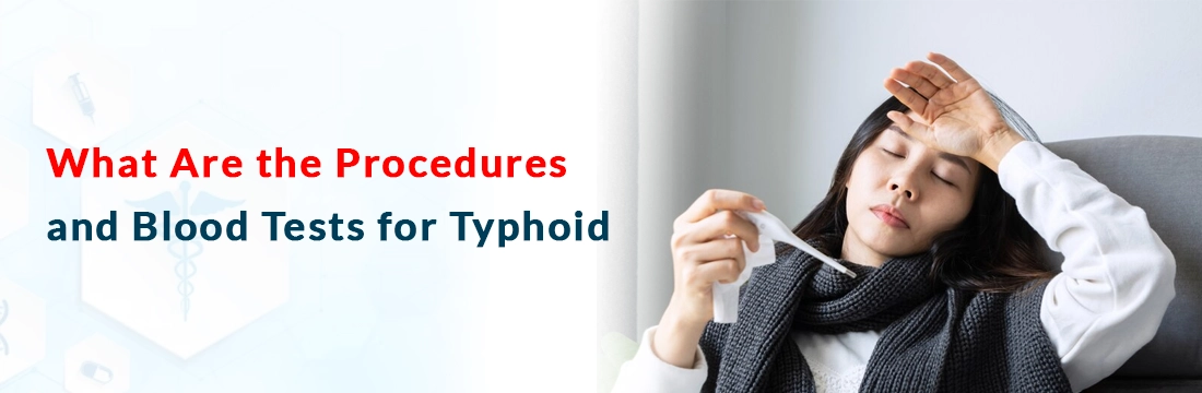 What Are the Procedures and Blood Tests for Typhoid